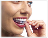�}�E�X�s�[�X�������u�����Q
